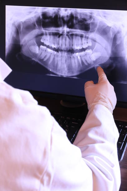 Best Emergency Treatment for Dental Infections or Abscesses in Rockport, TX