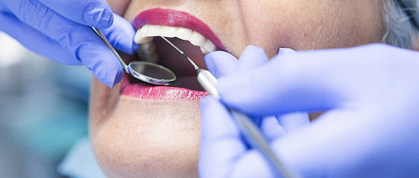 Best Emergency Dental Care for Broken or Chipped Teeth in Rockport, TX